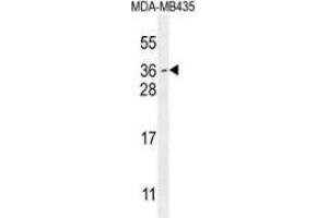 Western blot analysis in MDA-MB435 cell line lysates (35ug/lane) using MYCT1 Antibody (C-term). (Myc Target 1 antibody  (C-Term))