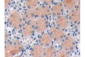 Immunohistochemistry (IHC) image for anti-Poly (ADP-Ribose) Polymerase 1 (PARP1) (AA 661-881) antibody (ABIN7439663)