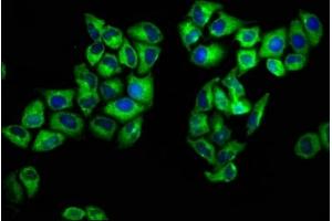 Immunofluorescence staining of Hela cells with ABIN7166495 at 1:133, counter-stained with DAPI. (ROS1 antibody  (AA 79-248))