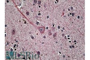 ABIN335168 (3. (SYT1 antibody  (Internal Region))
