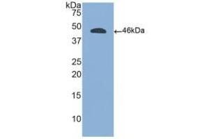 Detection of Recombinant CD45, Human using Polyclonal Antibody to Protein Tyrosine Phosphatase Receptor Type C (CD45) (CD45 antibody  (AA 193-575))