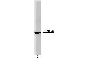 Western blot analysis of Rab4 on a rat cerebrum lysate. (Rab4 antibody  (AA 97-213))