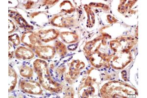 Formalin-fixed and paraffin embedded human kidney labeled with Anti-PRSS8 Polyclonal Antibody, Unconjugated (ABIN761891) at 1:200 followed by conjugation to the secondary antibody and DAB staining (PRSS8 antibody  (AA 65-165))