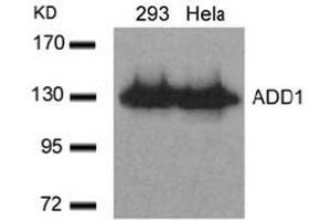 Image no. 3 for anti-Adducin 1 (Alpha) (ADD1) (Ser726) antibody (ABIN197407) (alpha Adducin antibody  (Ser726))