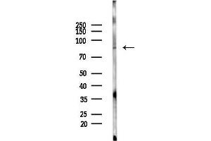 anti-Phosphate Regulating Endopeptidase Homolog, X-Linked (PHEX) antibody