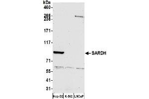Western Blotting (WB) image for anti-Sarcosine Dehydrogenase (SARDH) (AA 225-275) antibody (ABIN7452839)