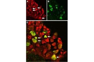 Expression of TRPV1 in rat DRG - Immunohistochemical staining of rat dorsal root ganglion (DRG) using Anti-TRPV1 (VR1) Antibody (ABIN7043841, ABIN7043988 and ABIN7043989). (TRPV1 antibody  (C-Term, Intracellular))