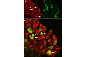 Expression of TRPV1 in rat DRG - Immunohistochemical staining of rat dorsal root ganglion (DRG) using Anti-TRPV1 (VR1) Antibody (ABIN7043841, ABIN7043988 and ABIN7043989). (TRPV1 antibody  (Intracellular))