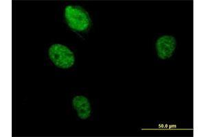 Immunofluorescence (IF) image for anti-RNA Binding Motif Protein 5 (RBM5) (AA 1-546) antibody (ABIN523557)