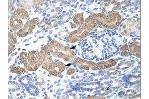 Image no. 1 for anti-Lethal(3) Malignant Brain Tumor-Like Protein 2 (L3MBTL2) (AA 576-625) antibody (ABIN202876) (L3MBTL2 antibody  (AA 576-625))