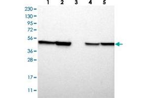 Western blot analysis of Lane 1: RT-4, Lane 2: U-251 MG, Lane 3: Human Plasma, Lane 4: Liver, Lane 5: Tonsil with ABHD3 polyclonal antibody . (ABHD3 antibody)