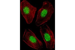 Fluorescent image of  cell stained with NR1H3 Antibody (Center) (ABIN653910 and ABIN2843147).
