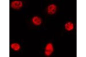 Immunofluorescence (fixed cells) (IF/ICC) image for anti-Bromodomain Containing 4 (BRD4) (N-Term) antibody (ABIN6260309)