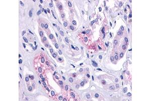 Anti-AVPR2 antibody  ABIN1048336 IHC staining of human kidney, renal tubules.