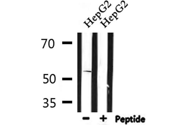 Serotonin Receptor 2B anticorps  (Internal Region)