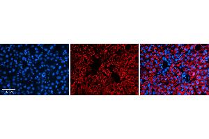 Rabbit Anti-ALDH6A1 Antibody   Formalin Fixed Paraffin Embedded Tissue: Human Liver Tissue Observed Staining: Cytoplasm in hepatocytes Primary Antibody Concentration: N/A Other Working Concentrations: 1:600 Secondary Antibody: Donkey anti-Rabbit-Cy3 Secondary Antibody Concentration: 1:200 Magnification: 20X Exposure Time: 0. (ALDH6A1 antibody  (Middle Region))