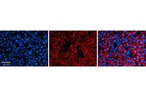 Rabbit Anti-ALDH6A1 Antibody   Formalin Fixed Paraffin Embedded Tissue: Human Liver Tissue Observed Staining: Cytoplasm in hepatocytes Primary Antibody Concentration: N/A Other Working Concentrations: 1:600 Secondary Antibody: Donkey anti-Rabbit-Cy3 Secondary Antibody Concentration: 1:200 Magnification: 20X Exposure Time: 0.