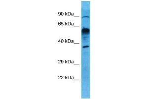 Host:  Rabbit  Target Name:  UXS1  Sample Type:  Lung Tumor lysates  Antibody Dilution:  1. (UXS1 antibody  (N-Term))