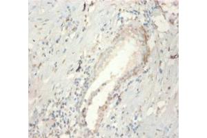 Immunohistochemistry of paraffin-embedded human prostate tissue using ABIN7152807 at dilution of 1:100 (FGF21 antibody  (AA 29-209))