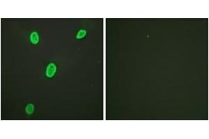 Immunofluorescence analysis of HeLa cells, using Histone H4 (Acetyl-Lys12) Antibody. (Histone H4 antibody  (acLys12))