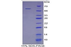 SDS-PAGE of Protein Standard from the Kit  (Highly purified E. (Selectin E/CD62e ELISA Kit)