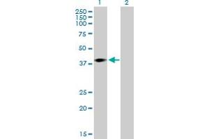 Western Blot analysis of ARPM1 expression in transfected 293T cell line by ARPM1 MaxPab polyclonal antibody. (ARPM1 antibody  (AA 1-372))