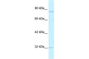 WB Suggested Anti-BRD2 Antibody Titration:  2. (BRD2 antibody  (C-Term))