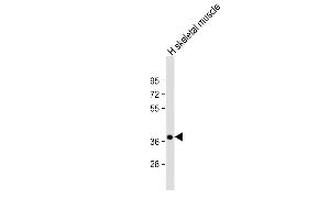 Anti-TRIB1 Antibody C-term at 1:2000 dilution + human skeletal muscle lysate Lysates/proteins at 20 μg per lane. (TRIB1 antibody  (C-Term))