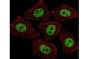 Immunofluorescence (IF) image for anti-X-Ray Repair Complementing Defective Repair in Chinese Hamster Cells 1 (XRCC1) (AA 407-435) antibody (ABIN3029645)