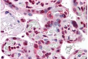 Immunohistochemistry (Formalin-fixed Paraffin-embedded Sections) (IHC (fp)) image for anti-Protein Phosphatase 1, Regulatory (Inhibitor) Subunit 2 (PPP1R2) (AA 1-101) antibody (ABIN574321)