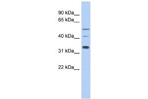 TCP11 antibody used at 1 ug/ml to detect target protein. (TCP11 antibody)