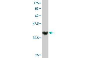 Western Blot detection against Immunogen (36. (NOVA1 antibody  (AA 408-507))