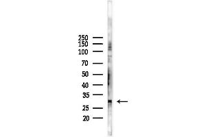 anti-Potassium Large Conductance Calcium-Activated Channel, Subfamily M, beta Member 2 (KCNMB2) (Internal Region) antibody