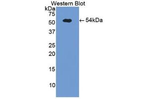 Detection of Recombinant SELE, Porcine using Polyclonal Antibody to E-selectin (Selectin E/CD62e antibody  (AA 260-420))