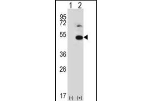 Western blot analysis of TRIP13 (arrow) using rabbit polyclonal TRIP13 Antibody (N-term) (ABIN389357 and ABIN2839463).