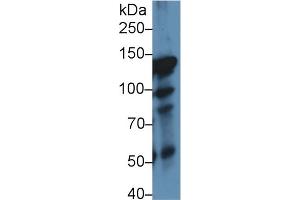 Western Blot; Sample: Rat Lung lysate; Primary Ab: 1µg/ml Rabbit Anti-Rat ITIH4 Antibody Second Ab: 0. (ITIH4 antibody  (AA 478-722))