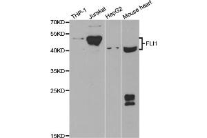 Western blot analysis of extracts of various cell lines, using FLI1 antibody. (FLI1 antibody)