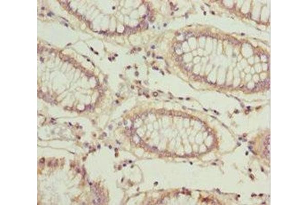 LARS2 antibody  (AA 1-250)
