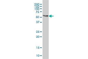 Western Blotting (WB) image for anti-V-Akt Murine Thymoma Viral Oncogene Homolog 3 (Protein Kinase B, Gamma) (AKT3) (AA 100-189) antibody (ABIN564308)