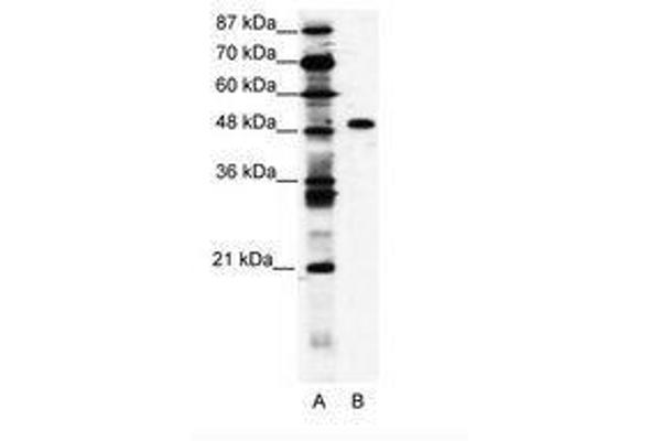 ZNF541 anticorps  (AA 783-832)