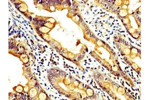 IHC image of ABIN7167302 diluted at 1:400 and staining in paraffin-embedded human small intestine tissue performed on a Leica BondTM system. (RAB35 antibody  (AA 1-201))