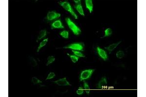 Immunofluorescence of monoclonal antibody to PSMB10 on HeLa cell. (PSMB10 antibody  (AA 1-273))