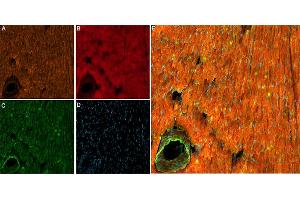ATX-II co-localizes with NaV1. (ATX-II peptide (Atto 647N))