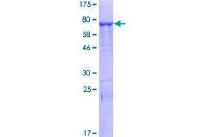 Phospholipase B Protein (PLB) (AA 1-488) (GST tag)