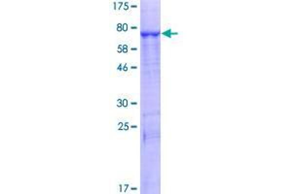 Phospholipase B Protein (PLB) (AA 1-488) (GST tag)