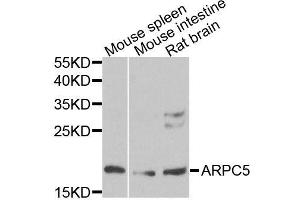 Western blot analysis of extracts of various cell lines, using ARPC5 antibody (ABIN5996446) at 1/1000 dilution. (ARPC5 antibody)