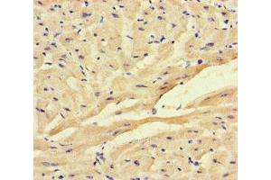 Immunohistochemistry of paraffin-embedded human heart tissue using ABIN7153010 at dilution of 1:100 (FSTL1 antibody  (AA 176-285))