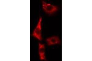 ABIN6279421 staining A549 cells by IF/ICC. (EIF3S1 antibody  (Internal Region))