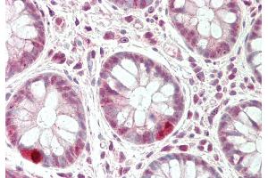 Rabbit Anti-CXXC1 antibody  Formalin Fixed Paraffin Embedded Tissue: Human Colon Primary antibody Concentration: 1:100 Secondary Antibody: Donkey anti-Rabbit-Cy3 Secondary Antibody Concentration: 1:200 Magnification: 20x Exposure Time: 0. (CXXC1 antibody  (Middle Region))