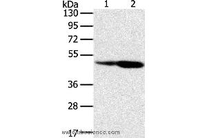 Western blot analysis of Hepg2 and hela cell, using SNX8 Polyclonal Antibody at dilution of 1:400 (SNX8 antibody)